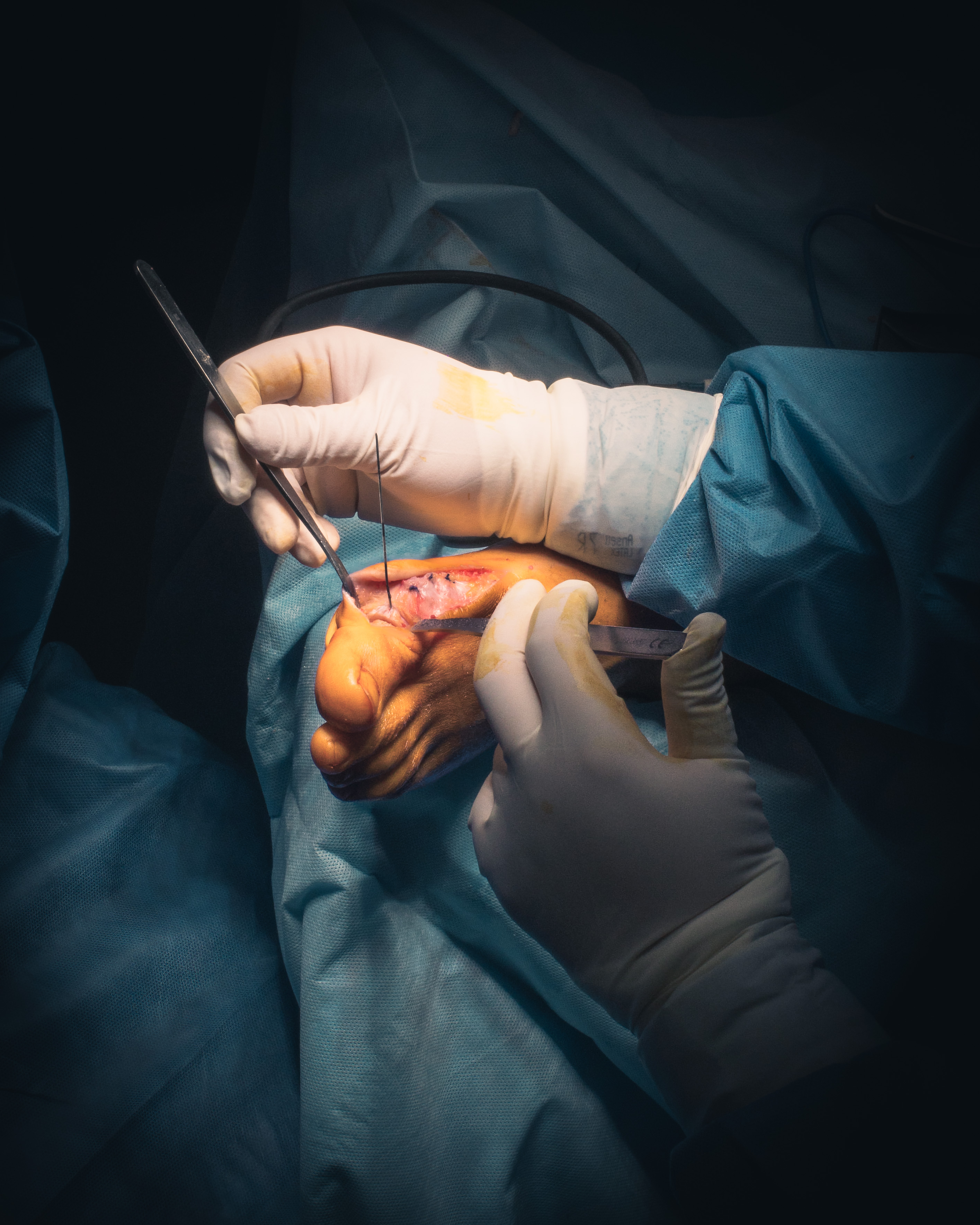 3 months in a surgery room.